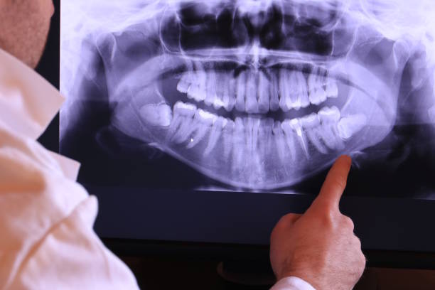 Best Emergency Root Canal Treatment in Harlan, IN