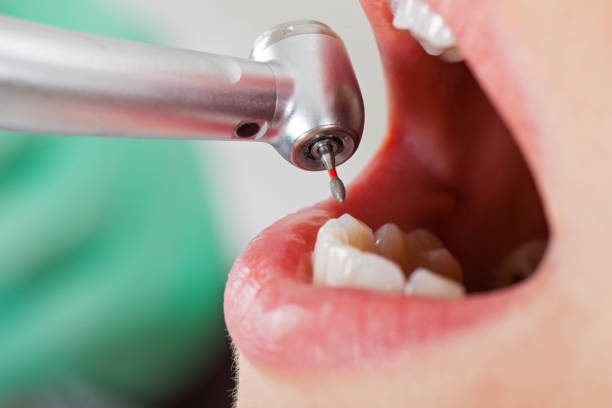 Best Emergency Treatment for Dental Infections or Abscesses in Harlan, IN